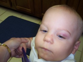 Sun Jun 11 09:22:26 2006

First black eye, which was earned falling onto a large cardboard 