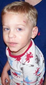 Sun 13 Apr 2008 11:33:07 PM

Andrew fell while running in the house and had his first emergency room visit for stitches, though it ended up being glue instead.