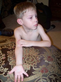 Thu 19 Aug 2010 09:38:15 PM

Andrew finally allowed dad to seriously work on pulling his first loose tooth (bottom left) and we got it out.