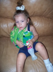 Fri 02 Sep 2011 09:24:02 AM

Gracie's arm was actually hurt somewhat badly while playing with a little friend of hers (play date). Ellen took her to the doctor the next day and they 